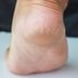Review: This $25 Foot Peel Is Better Than a Pedicure